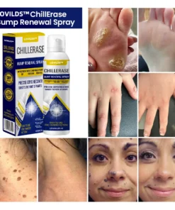 LOVILDS™ ChillErase Bump Renewal Spray