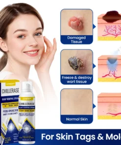 LOVILDS™ ChillErase Bump Renewal Spray