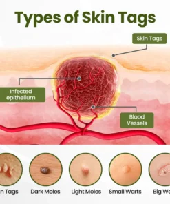 LOVILDS® MagneErase Renewal Cream