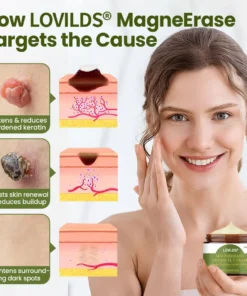 LOVILDS® MagneErase Renewal Cream