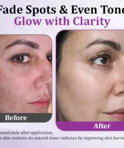 LOVILDS™ MelantraX Advanced Anti-Hyperpigmentation Essence