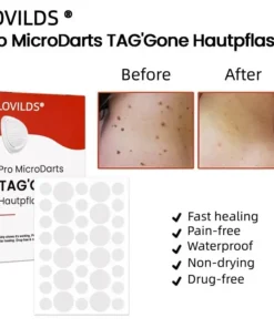 LOVILDS® Pro MicroDarts TAG'Gone Skin Tag Removal Patch