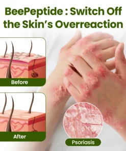 LOVILDS® BeePeptide RootSoft DualRelief Cream