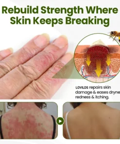 LOVILDS® BeePeptide RootSoft DualRelief Cream