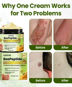 LOVILDS® BeePeptide RootSoft DualRelief Cream
