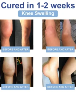 LOVILDS™ Black Rice Pain Healing Bone Cream