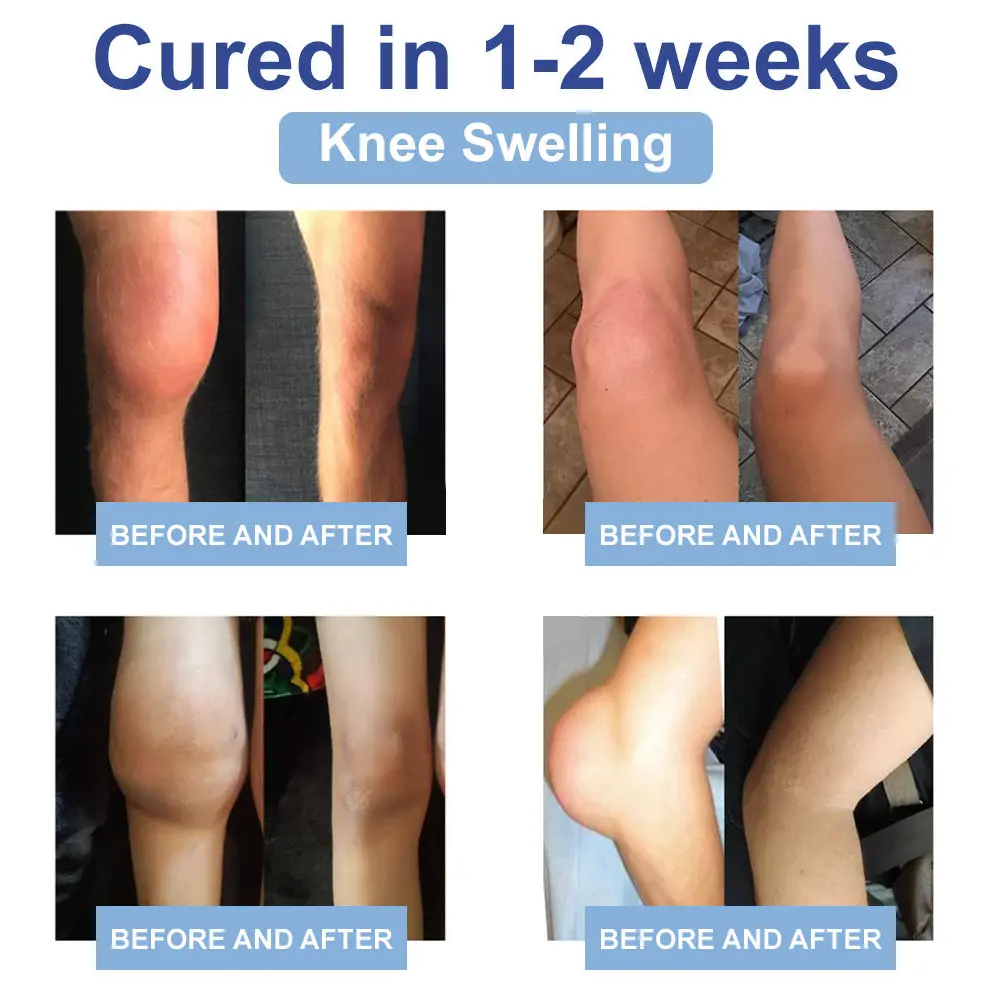 LOVILDS™ Black Rice Pain Healing Bone Cream