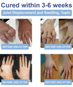 LOVILDS™ Black Rice Pain Healing Bone Cream