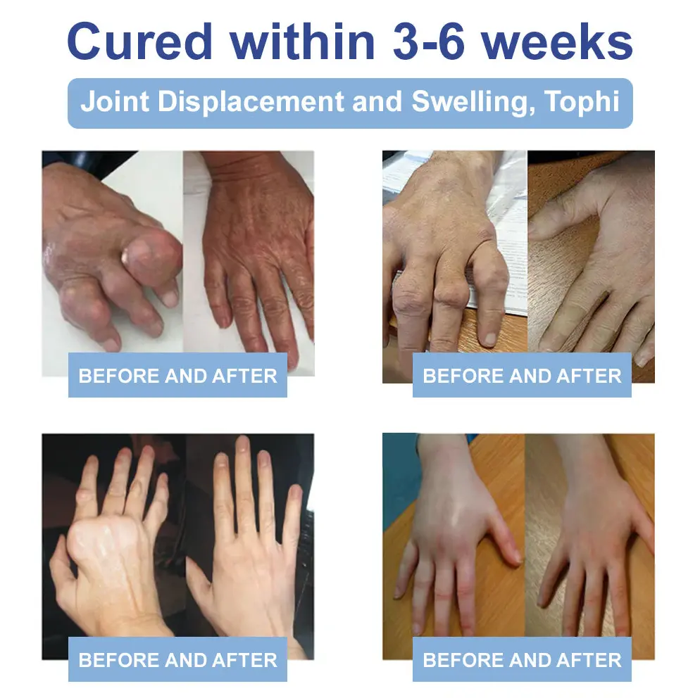 LOVILDS™ Black Rice Pain Healing Bone Cream