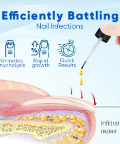 LOVILDS® OnyxoGuard Nail Growth and Repair Serum