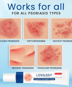 LOVILDS™ Psoriasis Treatment Cream