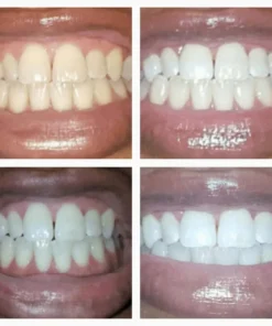 LOVILDS™Extra-Strength Teeth Whitening Serum Pen + Dual-Peroxide Formula & Xylitol