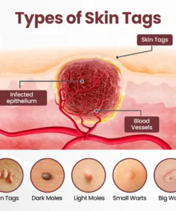 LOVILDS®KeraErase Dual-Action Renewal Cream