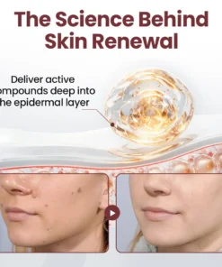 LOVILDS®KeraErase Dual-Action Renewal Cream