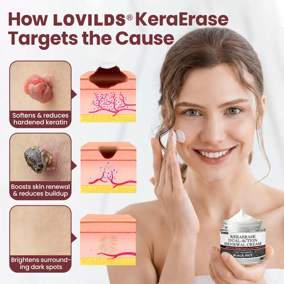 LOVILDS®KeraErase Dual-Action Renewal Cream