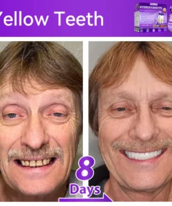 Lovilds® 𝐻𝑦𝑑𝑟𝑜𝑥𝑦𝑎𝑝𝑎𝑡𝑖𝑡𝑒 𝑇𝑜𝑜𝑡ℎ 𝑅𝑒𝑠𝑡𝑜𝑟𝑎𝑡𝑖𝑣𝑒 𝑃𝑜𝑤𝑑𝑒𝑟