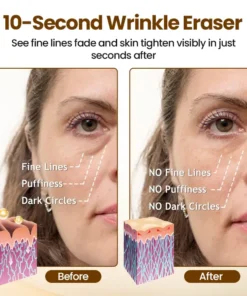 Lovilds® 10s Wrinkle Serum