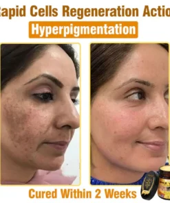 𝐋𝐎𝐕𝐈𝐋𝐃𝐒™ 𝐁𝐞𝐞 𝐕𝐞𝐧𝐨𝐦 𝐀𝐥𝐥-𝐢𝐧-𝐎𝐧𝐞 𝐂𝐫𝐞𝐚𝐦