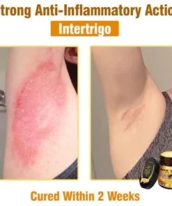 𝐋𝐎𝐕𝐈𝐋𝐃𝐒™ 𝐁𝐞𝐞 𝐕𝐞𝐧𝐨𝐦 𝐀𝐥𝐥-𝐢𝐧-𝐎𝐧𝐞 𝐂𝐫𝐞𝐚𝐦