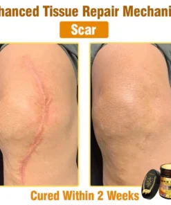 𝐋𝐎𝐕𝐈𝐋𝐃𝐒™ 𝐁𝐞𝐞 𝐕𝐞𝐧𝐨𝐦 𝐀𝐥𝐥-𝐢𝐧-𝐎𝐧𝐞 𝐂𝐫𝐞𝐚𝐦