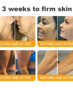 𝐋𝐎𝐕𝐈𝐋𝐃𝐒™ 𝐁𝐞𝐞 𝐕𝐞𝐧𝐨𝐦 𝐀𝐥𝐥-𝐢𝐧-𝐎𝐧𝐞 𝐂𝐫𝐞𝐚𝐦