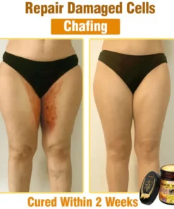 𝐋𝐎𝐕𝐈𝐋𝐃𝐒™ 𝐁𝐞𝐞 𝐕𝐞𝐧𝐨𝐦 𝐀𝐥𝐥-𝐢𝐧-𝐎𝐧𝐞 𝐂𝐫𝐞𝐚𝐦