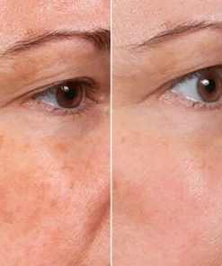 ๐๐๐๐๐๐๐ยฎ๏ธ ๐๐ญ๐๐ฆ ๐๐๐ฅ๐ฅโ๐๐ง๐ฌ๐ฉ๐ข๐ซ๐๐ &Blue Copper Peptide ๐๐ซ๐ข๐ง๐ค๐ฅ๐-๐๐๐๐ข๐ง๐ข๐ง๐ ๐๐๐ซ๐ฎ๐ฆ