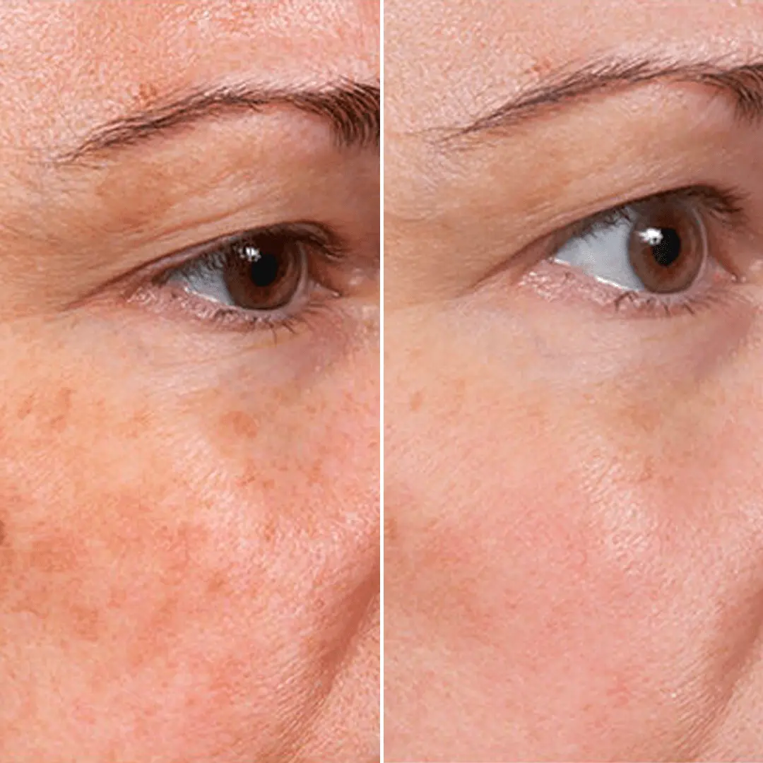 ๐๐๐๐๐๐๐ยฎ๏ธ ๐๐ญ๐๐ฆ ๐๐๐ฅ๐ฅโ๐๐ง๐ฌ๐ฉ๐ข๐ซ๐๐ &Blue Copper Peptide ๐๐ซ๐ข๐ง๐ค๐ฅ๐-๐๐๐๐ข๐ง๐ข๐ง๐ ๐๐๐ซ๐ฎ๐ฆ