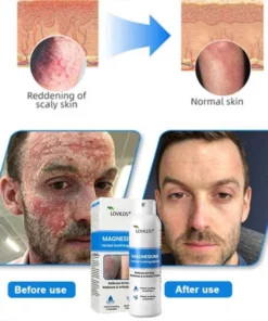 𝐋𝐎𝐕𝐈𝐋𝐃𝐒® Magnesium Herbal Spray