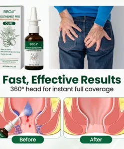 LOVIDS® SootheMist PRO Hemorrhoid Spray