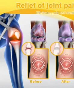 LOVILDS™ Bee Venom Pain-Relief Bone Healing Cream