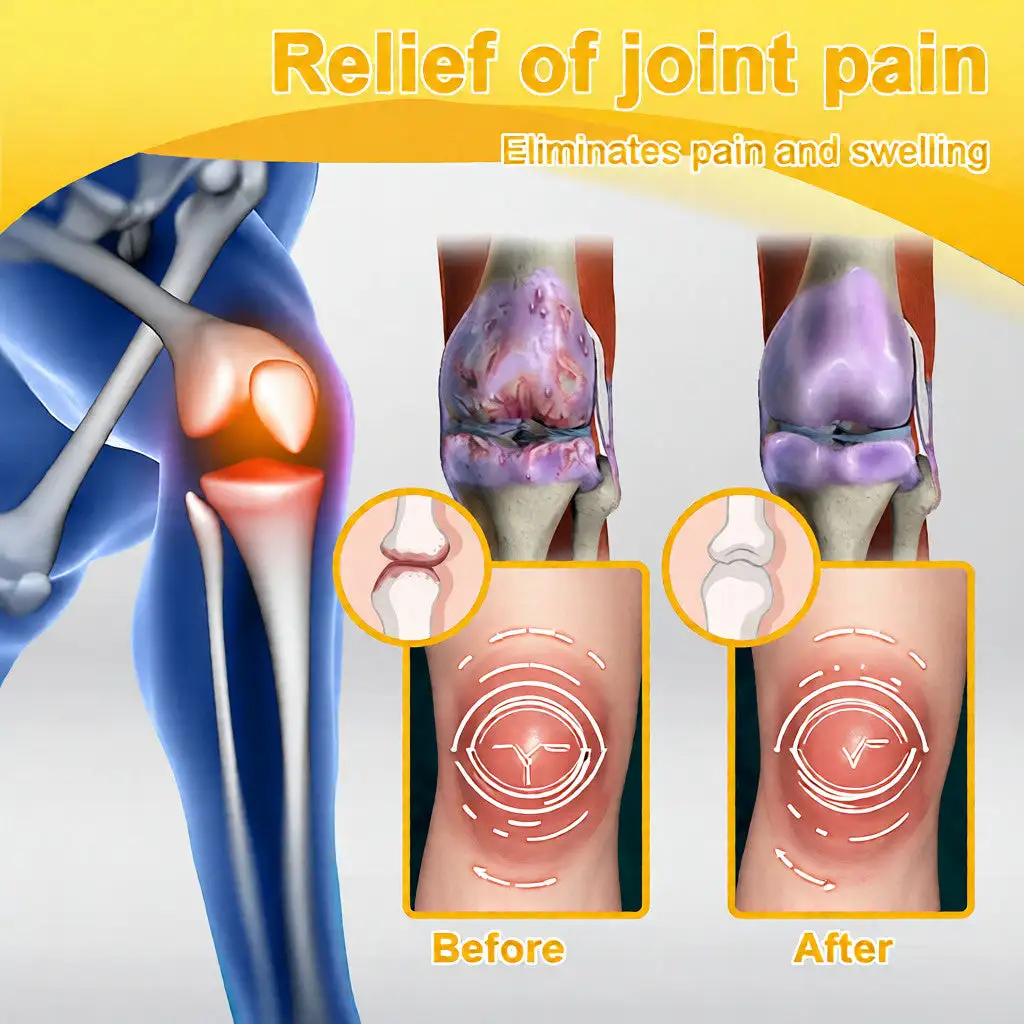 LOVILDS™ Bee Venom Pain-Relief Bone Healing Cream