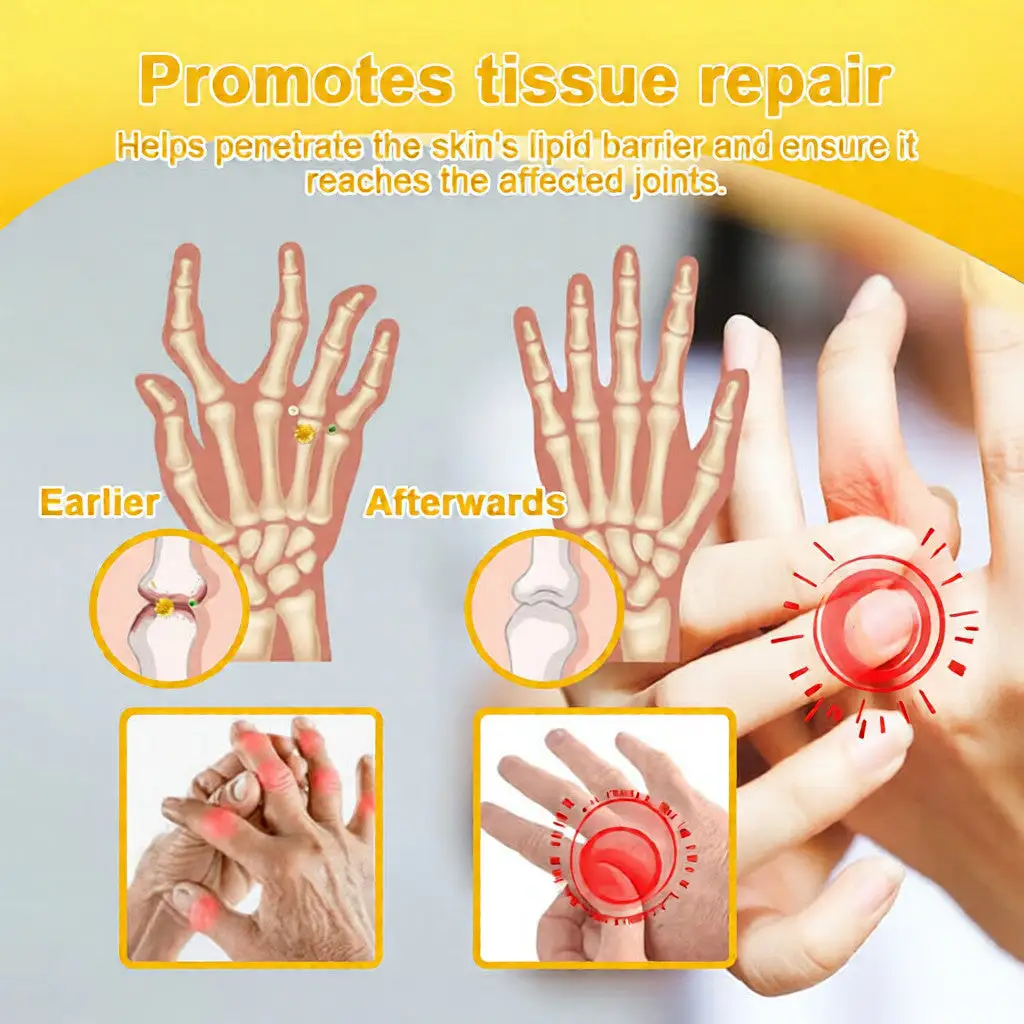 LOVILDS™ Bee Venom Pain-Relief Bone Healing Cream