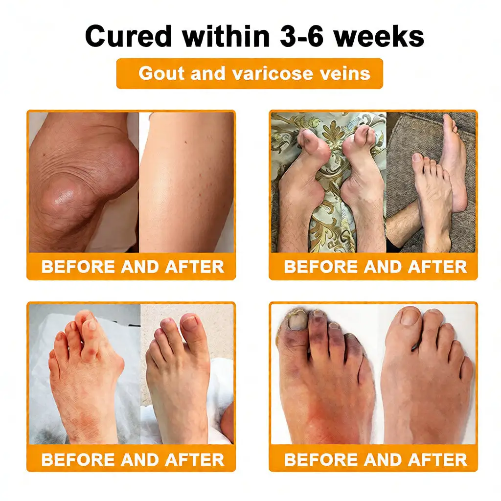 LOVILDS™ Bee Venom Pain-Relief Bone Healing Cream