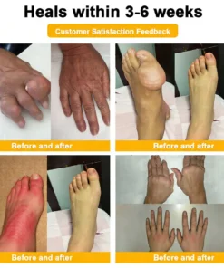 LOVILDS™ Bee Venom Pain-Relief Bone Healing Cream