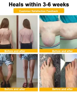 LOVILDS™ Bee Venom Pain-Relief Bone Healing Cream