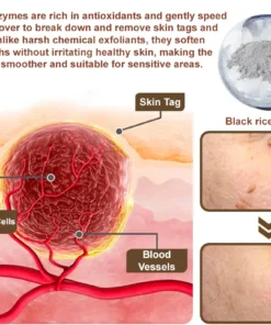 LOVILDS® Black Rice Skin Repair Essence Cream (Removes warts and skin growths, improves keratin buildup and seborrheic dermatitis, follicular keratosis, age spots, and bruising)