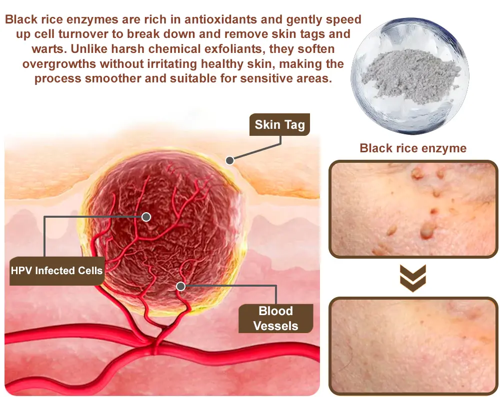 LOVILDS® Black Rice Skin Repair Essence Cream (Removes warts and skin growths, improves keratin buildup and seborrheic dermatitis, follicular keratosis, age spots, and bruising)