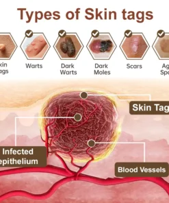 LOVILDS® Black Rice Skin Repair Essence Cream (Removes warts and skin growths, improves keratin buildup and seborrheic dermatitis, follicular keratosis, age spots, and bruising)