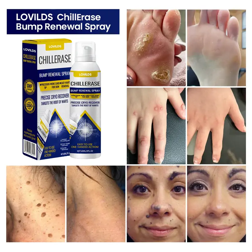 LOVILDS™ ChillErase Bump Renewal Spray 2026