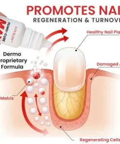 LOVILDS™ Fungi-Cure Max Fast-Acting Relief for Fungal Nail Infections