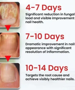 LOVILDS™ Fungi-Cure Max Fast-Acting Relief for Fungal Nail Infections