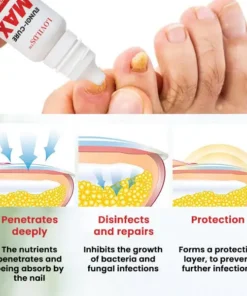 LOVILDS™ Fungi-Cure Max Fast-Acting Relief for Fungal Nail Infections