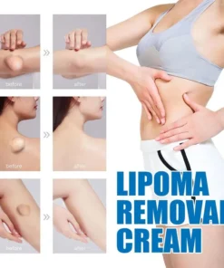 LOVILDS™ LIPOMA CREAM