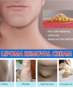 LOVILDS™ LIPOMA CREAM