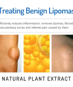 LOVILDS™ LIPOMA CREAM