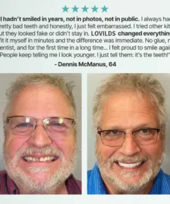 LOVILDS™ Medical Full Denture with Strong Suction