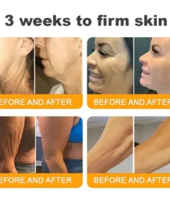 LOVILDS™ Skin Restoration Cream