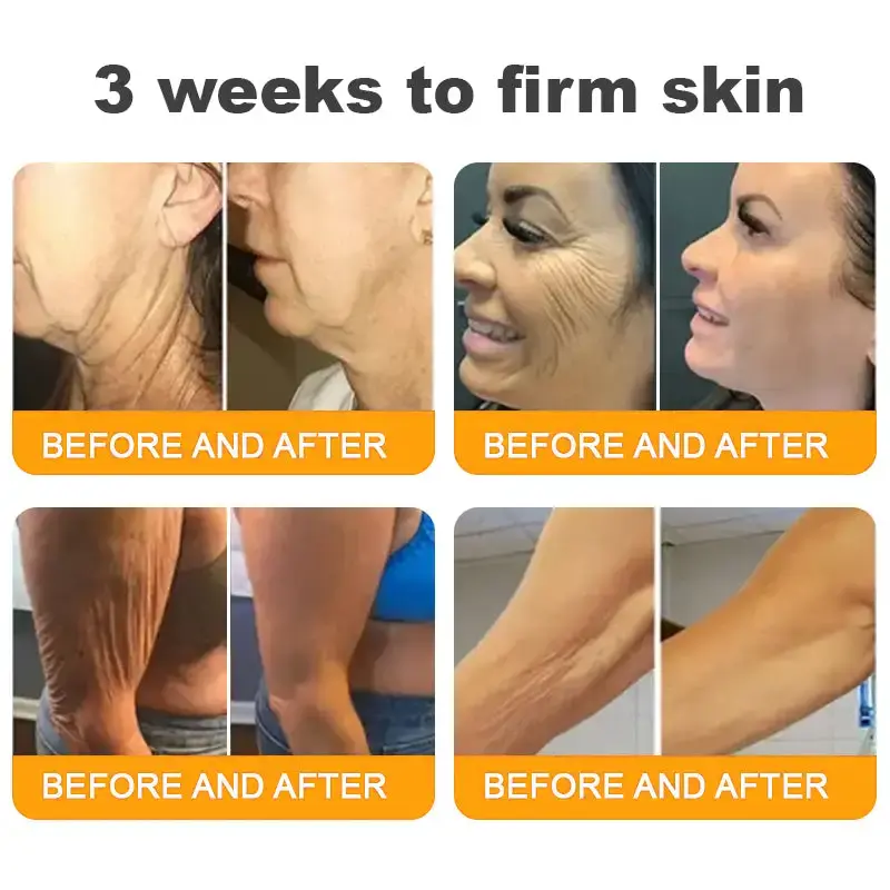 LOVILDS™ Skin Restoration Cream