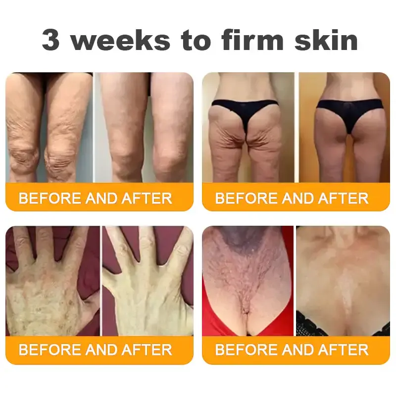 LOVILDS™ Skin Restoration Cream